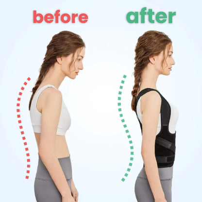 Posture Corrector | Adjustable Ergonomic Back Support | Optimal Comfort to Improve Posture