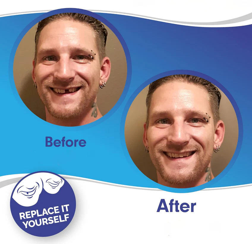 Dental Veneers | Professional Dental Prosthetics with Custom Fit | Restore Your Natural Smile