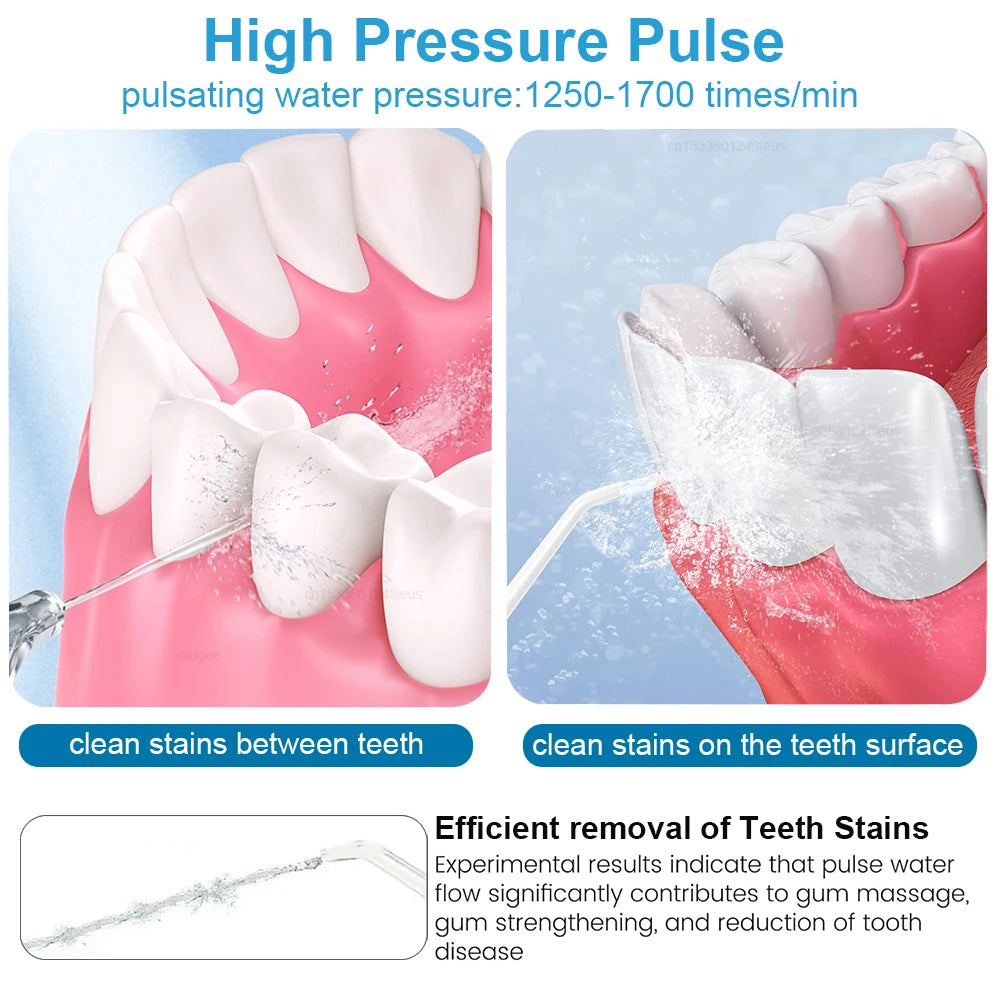 Irrigatore Orale Elettrico con 10 Impostazioni e Design Portatile per Igiene Orale Efficace 3