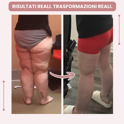 Leggings Donna | Leggings 3D a Vita Alta con Supporto per Lipedema | Comfort e Vestibilità Ottimale per Uso Quotidiano 4