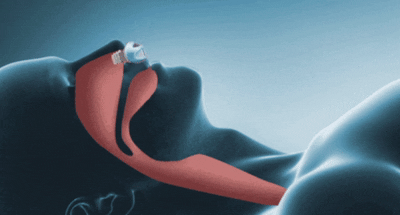 Micro CPAP | Macchina per Apnea Notturna Portatile e Silenziosa con Auricolari Ergonomici | Soluzione Compatta per un Sonno Ristoratore