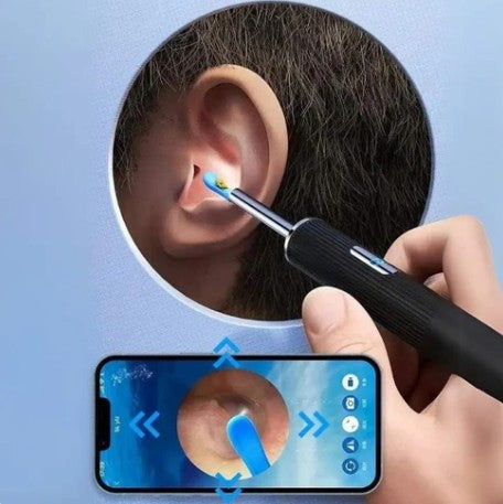Digital WiFi Otoscope for Ear Cleaning, 1080P Camera with 6 LEDs, Waterproof IP67 Earwax Removal Kit for iPhone, Android, and Kids
