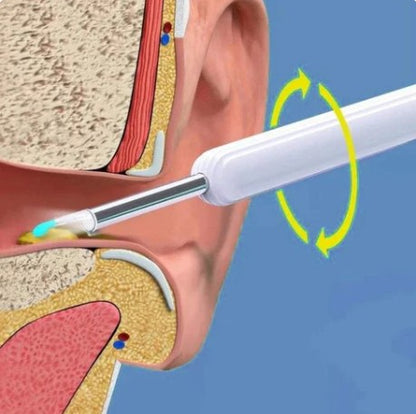 Digital WiFi Otoscope for Ear Cleaning, 1080P Camera with 6 LEDs, Waterproof IP67 Earwax Removal Kit for iPhone, Android, and Kids