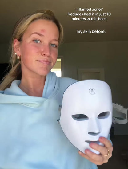 Maschera Viso LED | Terapia della Luce con Ringiovanimento e Collagene | Trattamento Anti-invecchiamento per Pelle Radiosa